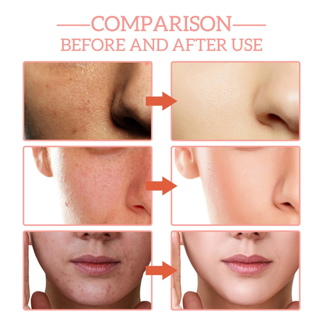 Anti-wrinkle 5-in-1 Facial Serum